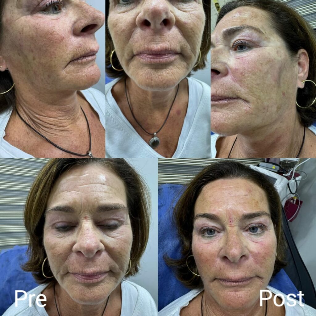 محاربة الشيخوخة